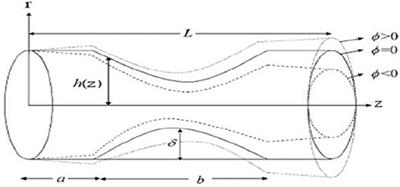 Mathematical Modeling of Blood Flow With the Suspension of Nanoparticles Through a Tapered Artery With a Blood Clot